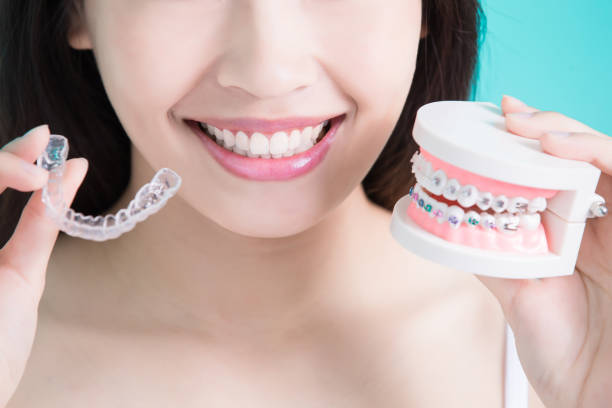 Braces and Invisalign